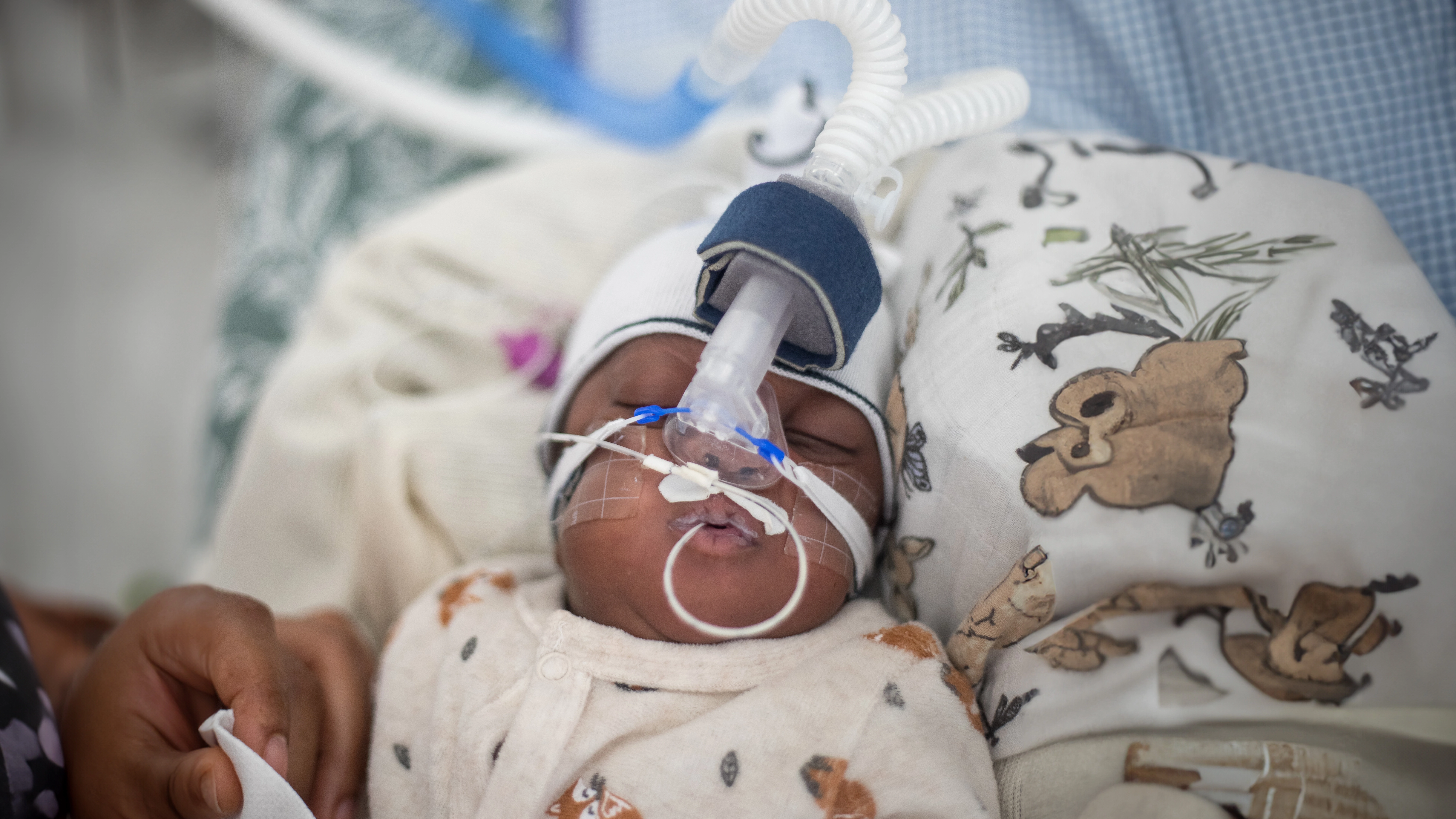 NICU